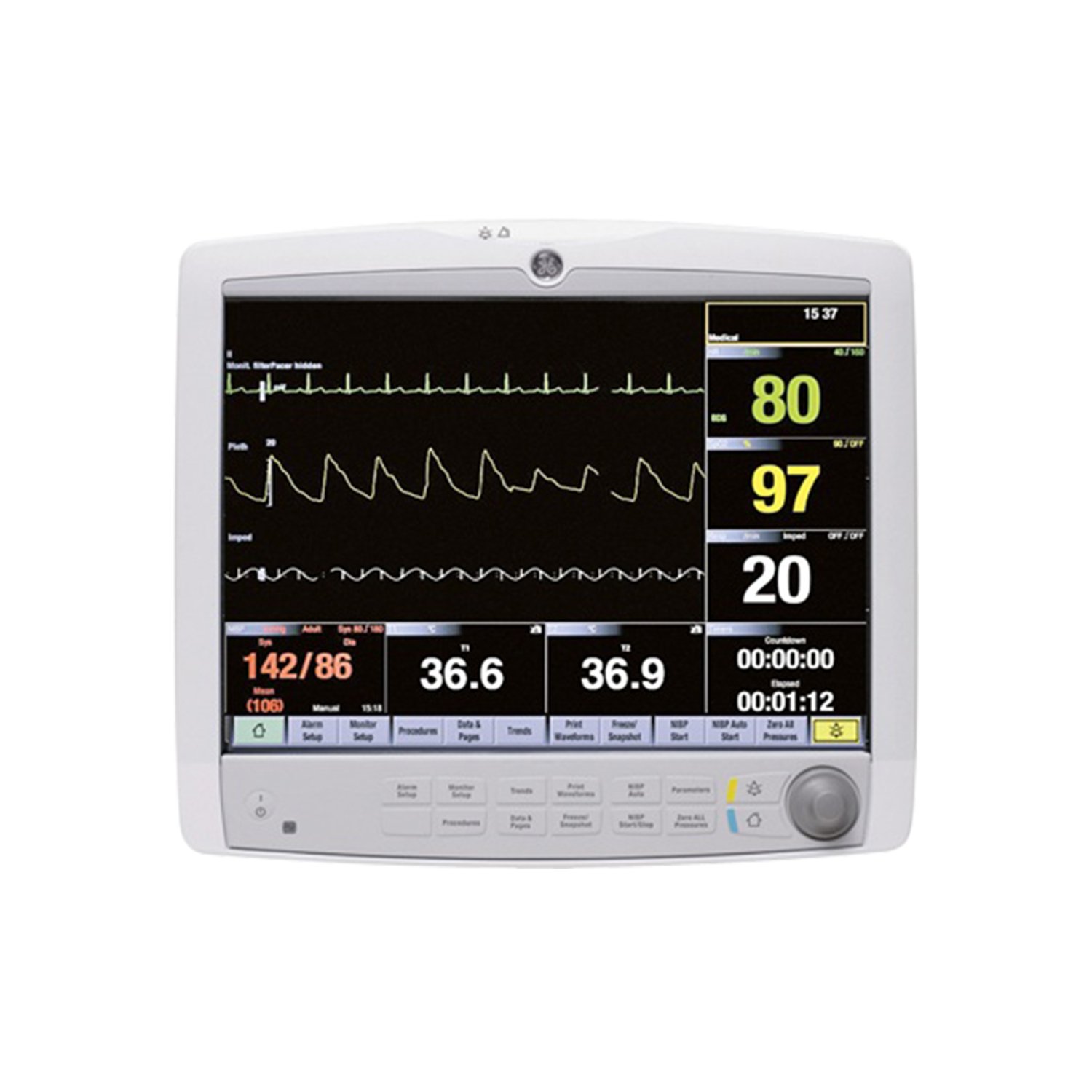 Anesthesia Gas Monitor